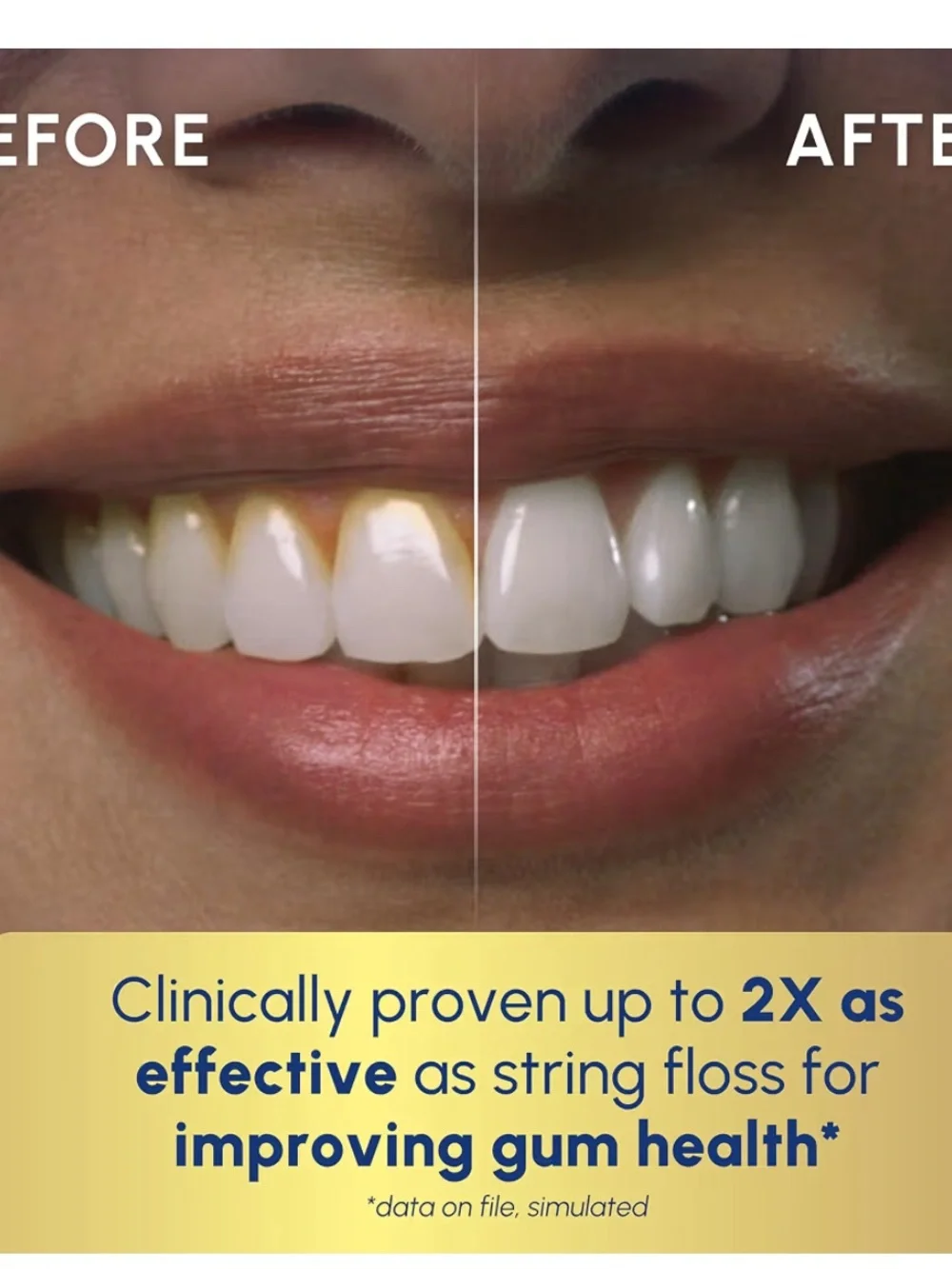 Waterpik cordless advanced